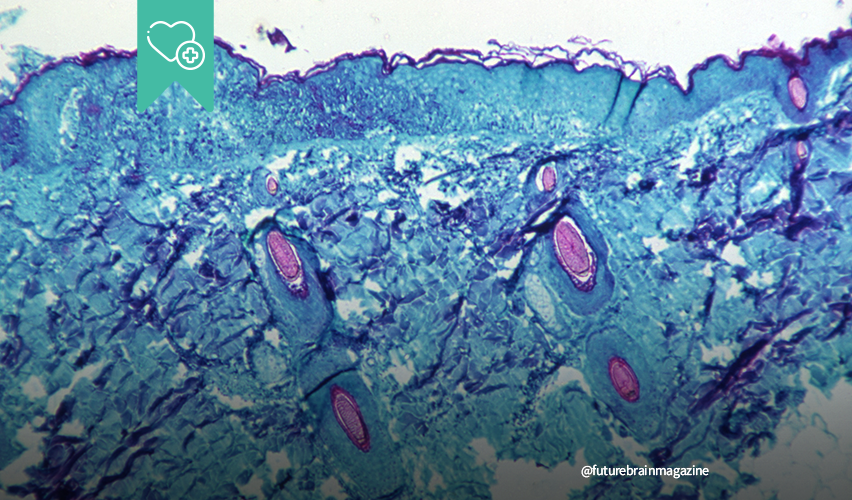 Monkeypox virus